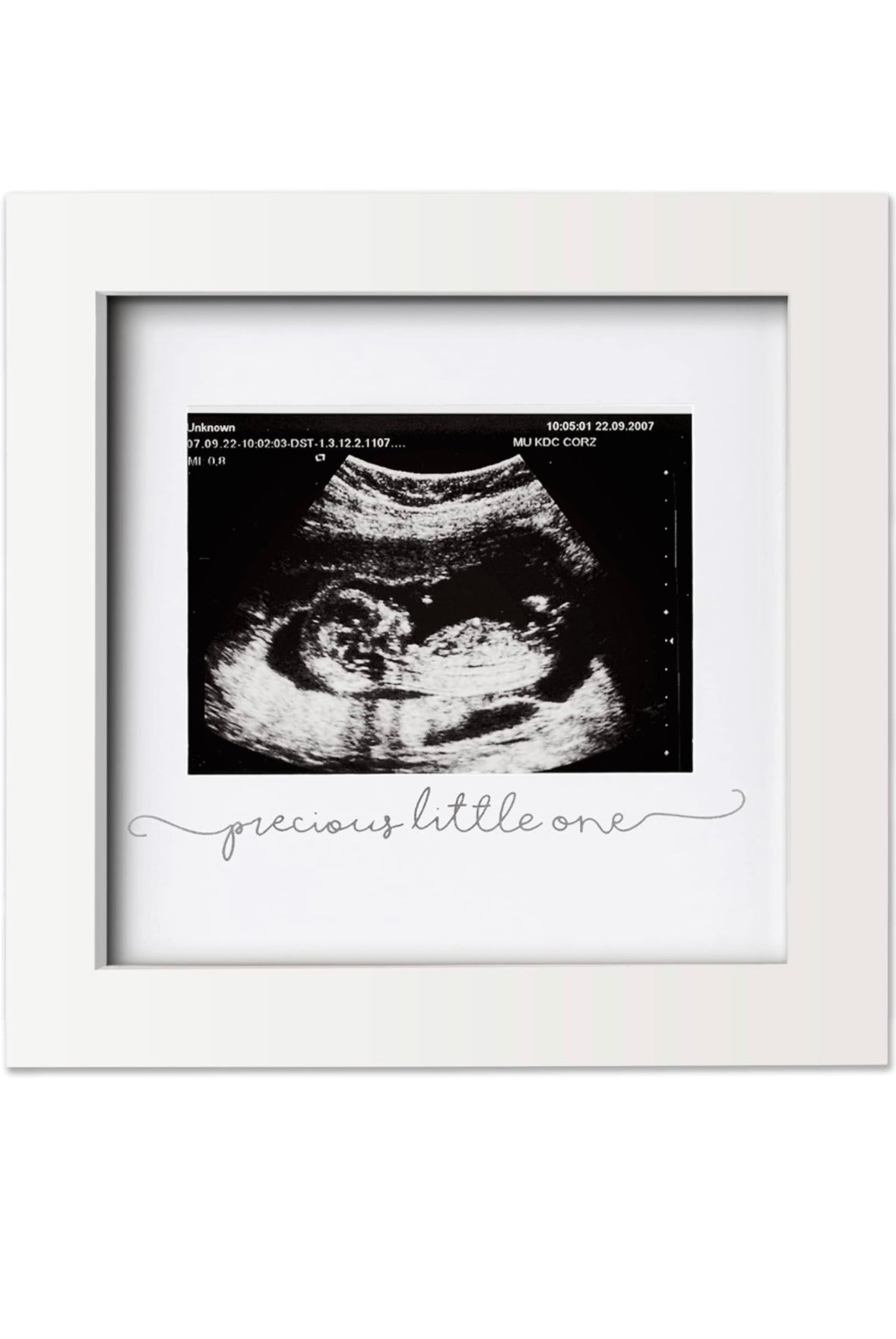 Baby Sonogram Picture Frame.