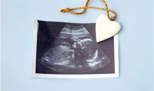 Due Date Calculator: How Many Weeks Pregnant Am I?