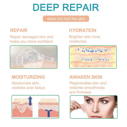 لفة سيليكون لآثار الندوب من أليفر، 3 أمتار