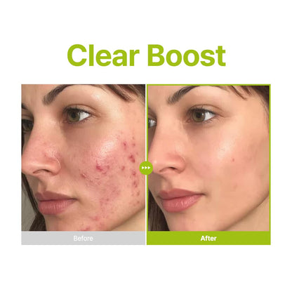 Purito Azelaic Acid 10 Kojic Tea Tree Serum (30ml)