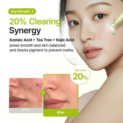 Purito Azelaic Acid 10 Kojic Tea Tree Serum (30ml)
