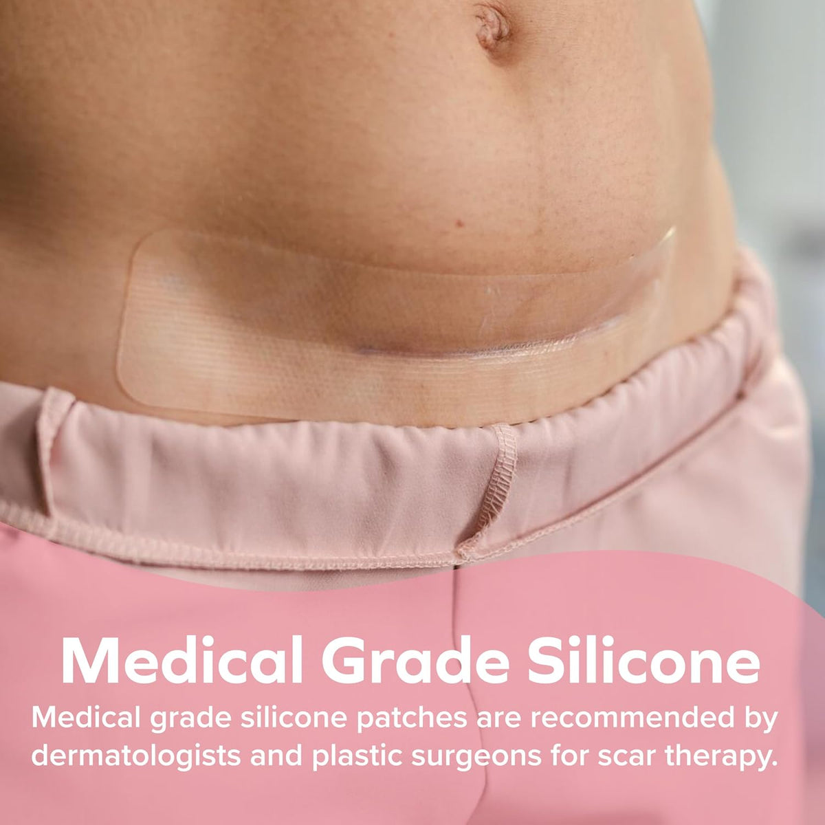 Dr. Talbot's C-Section Silicone Scar Patches, Reusable - Pack of 6